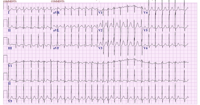 quick flutter in chest