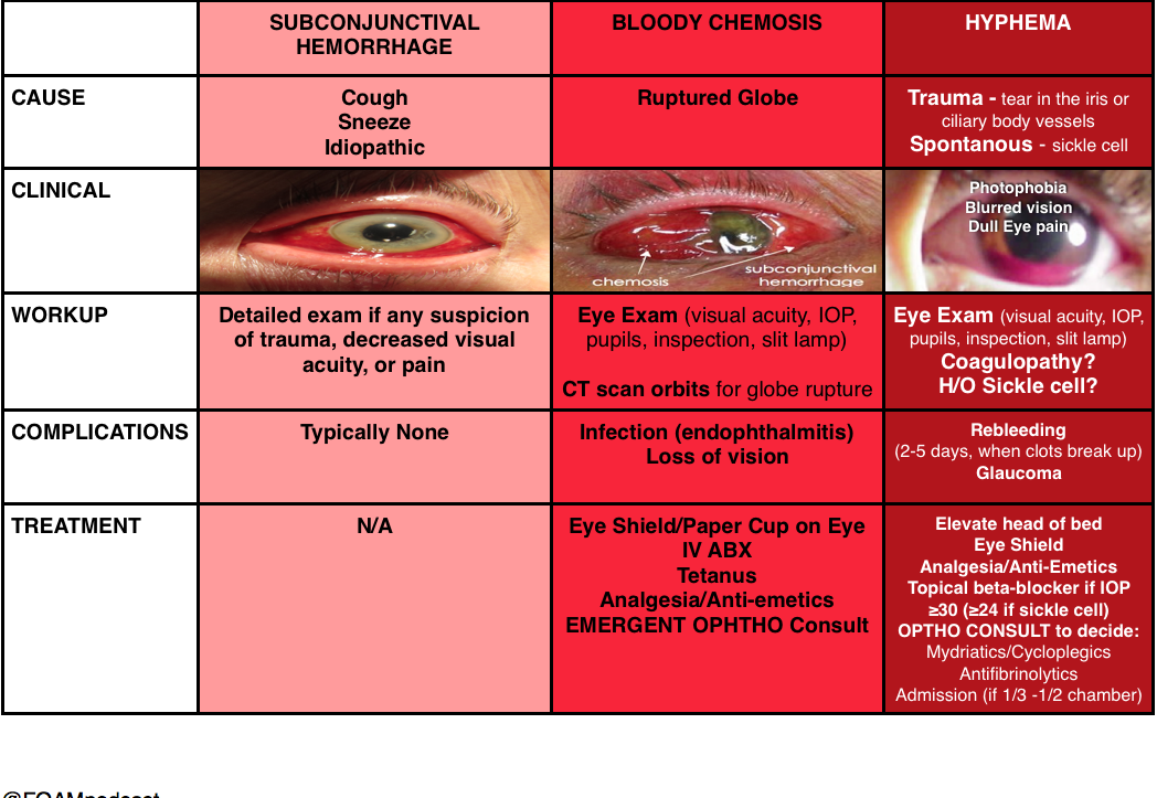 Hyphema Complications Hyphema Complications