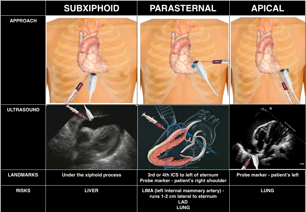 episode-54-the-pericardium-foamcast