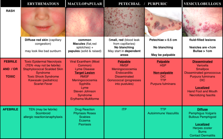 vasculitis-doccheck