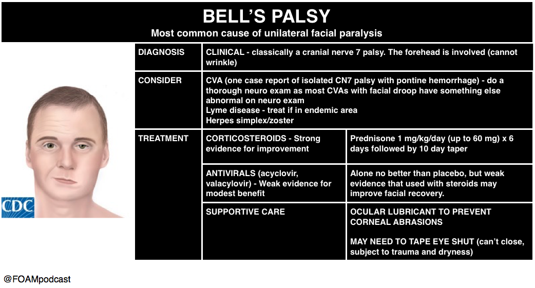 Bell S Palsy And Burns Foamcast