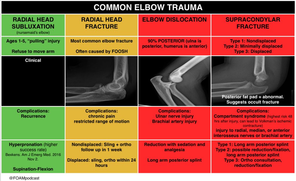 Complex Elbow Injuries Episode 61 – The Elbow – FOAMcast