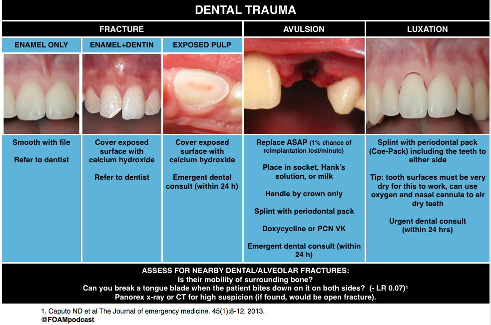 episode-62-dental-emergencies-foamcast