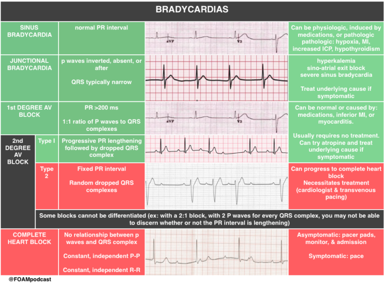 Episode 63 – Bradycardia – FOAMcast