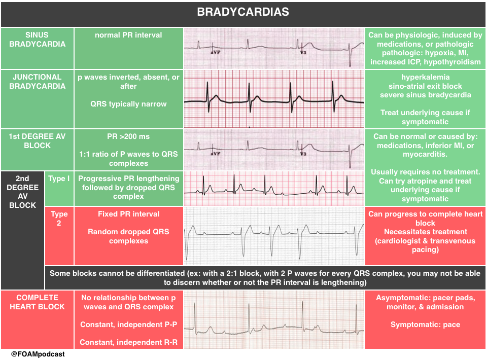 episode-63-bradycardia-foamcast