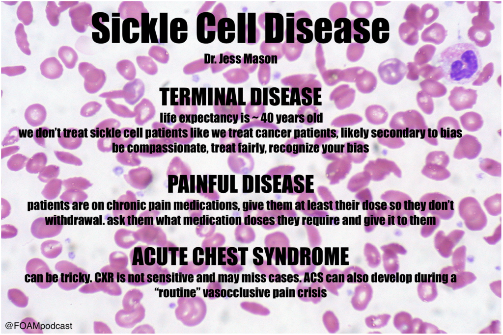 sickle cell