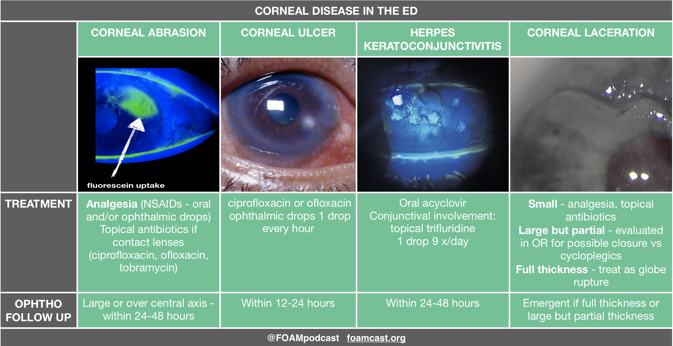 Corneal Laceration