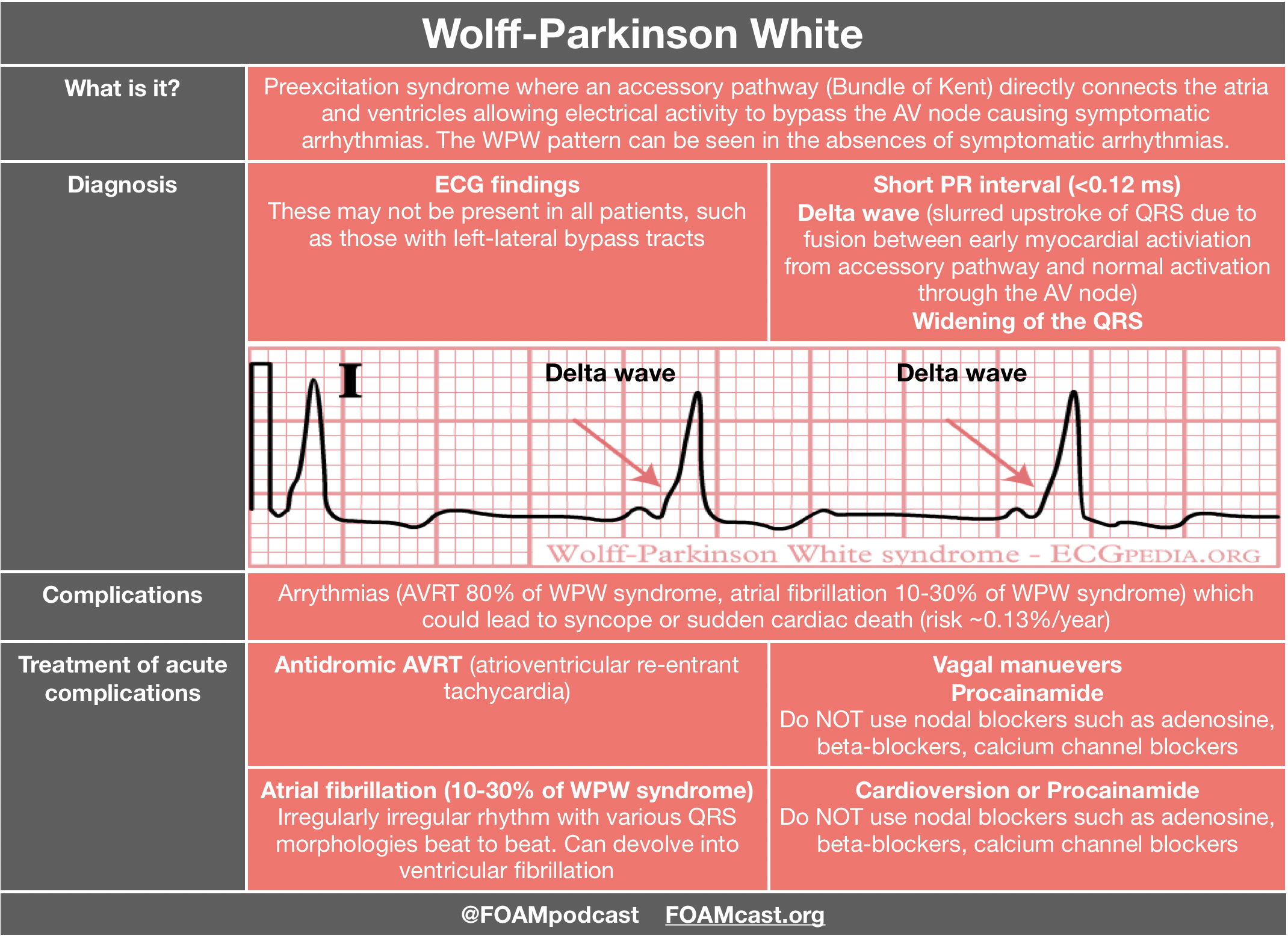 supraventricular-tachycardia-treatment-foamcast